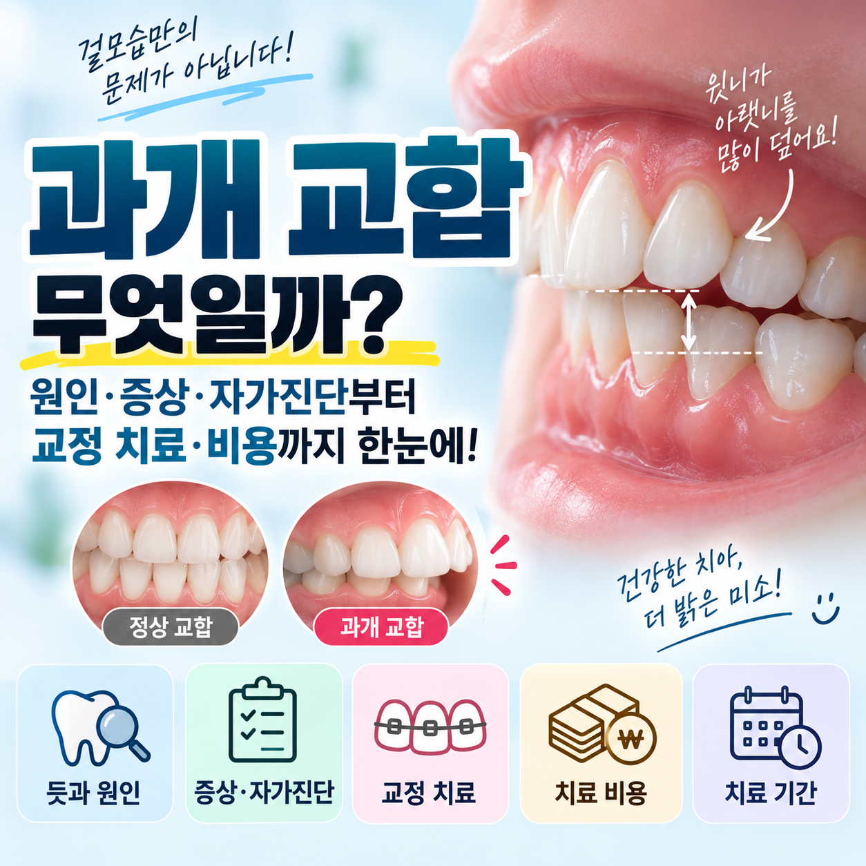 과개 교합 치료