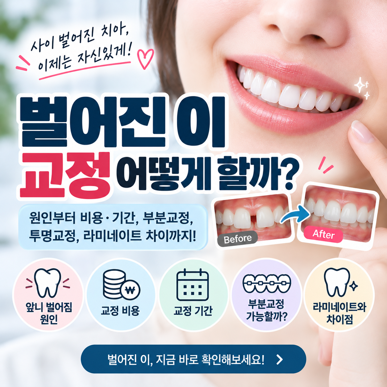 벌어진 이 교정