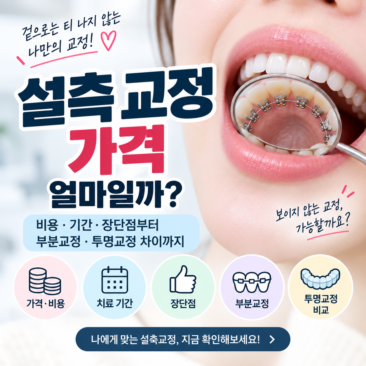 설측 교정 가격