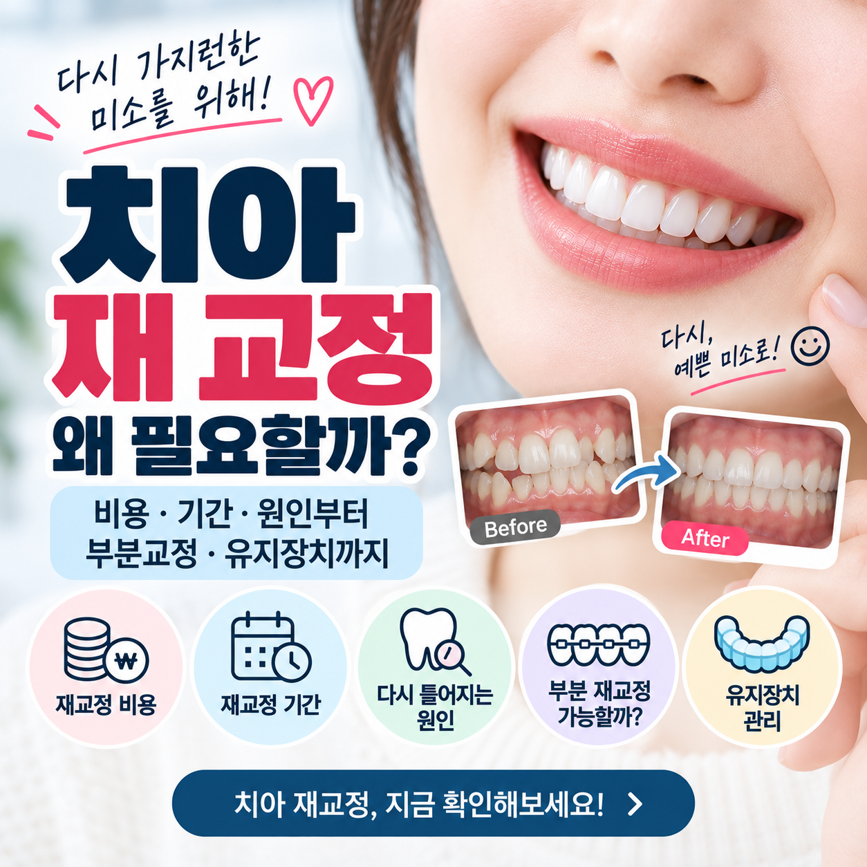 치아 재 교정